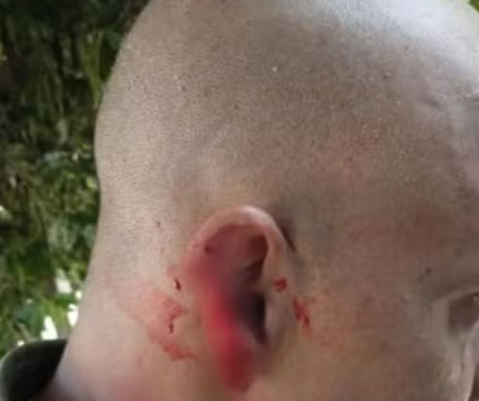 ​Homem arranca parte da orelha de policial durante abordagem